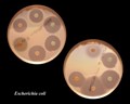 escherichia coli